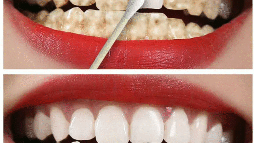 تبييض الأسنان في المنزل