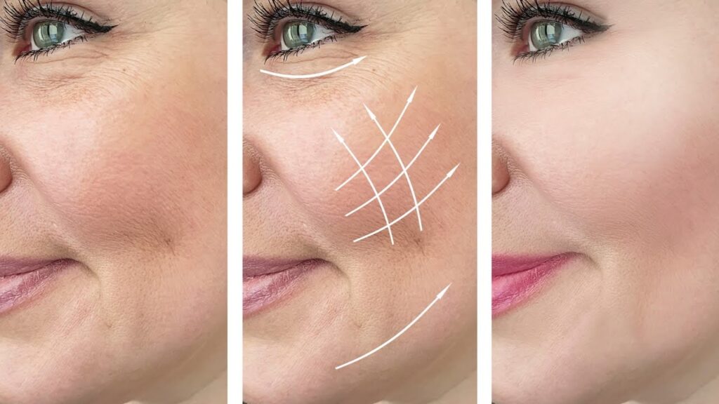 وصفة طبيعية للقضاء على التجاعيد